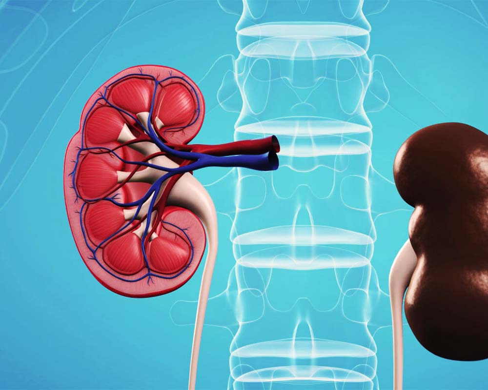 بیماری مزمن کلیه و جلوگیری و پیشگیری با دیاسیس